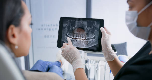 Licensed Root Canal Treatment service in Huntsville, AR - Smile Center Dentistry